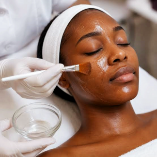 Glycolic Peel (20%)